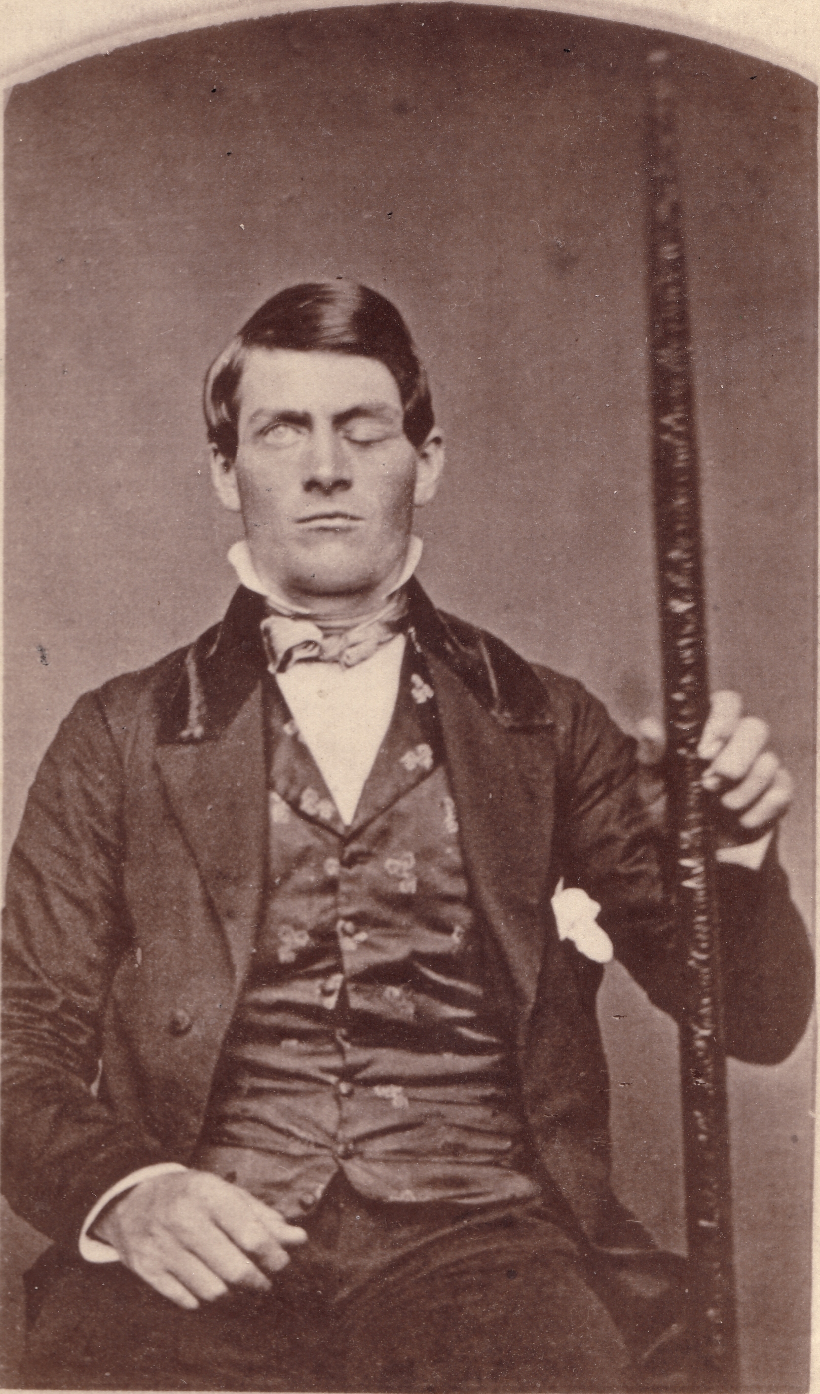 Phineas Gage